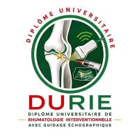 DIPLOME UNIVERSITAIRE D ECHOGRAPHIE INTERVENTIONNELLE EN RHUMATOLOGIE A L UFRSDS  UJKZ